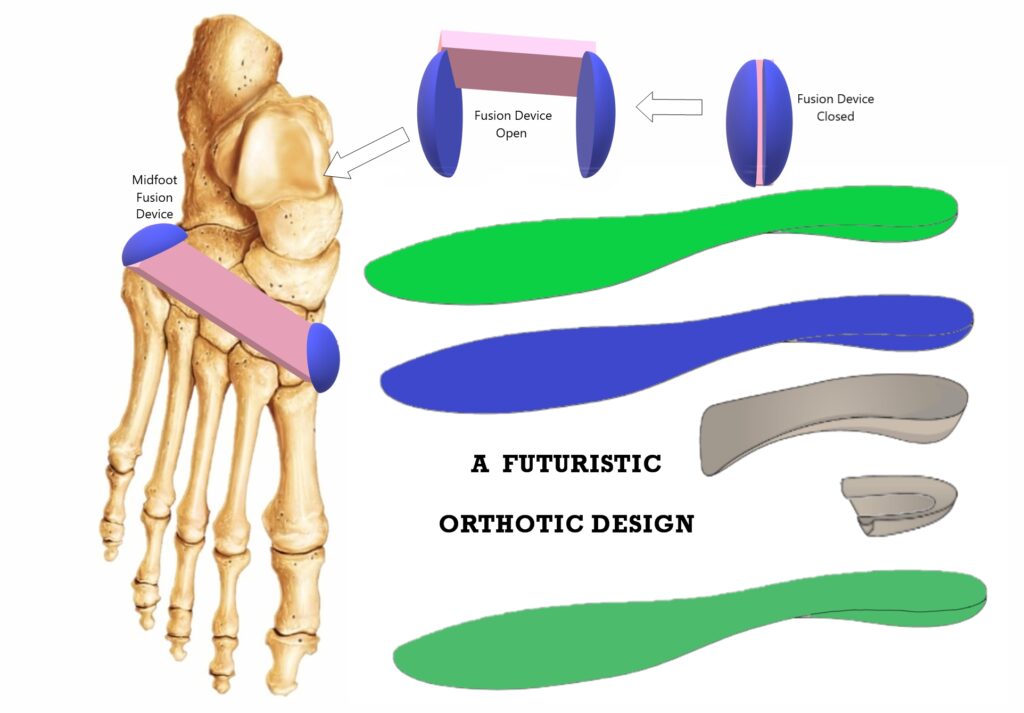 A Futuristic Orthotic Design Emerging Innovators Research Publications
